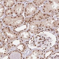 Anti-SAP30BP antibody produced in rabbit 