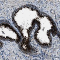 Anti-SCARB2 antibody produced in rabbit 