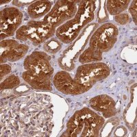 Anti-SCGB2B2 antibody produced in rabbit