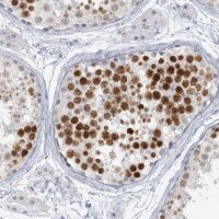 Anti-SCML1 antibody produced in rabbit