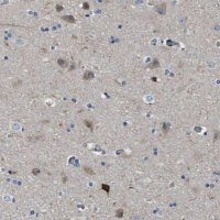 Anti-SCN4B antibody produced in rabbit HPA017293-100UL