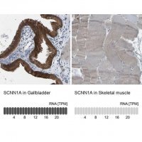 Anti-SCNN1A antibody produced in rabbit 