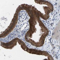 Anti-SCNN1A antibody produced in rabbit 