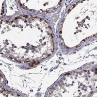 Anti-SCNN1D antibody produced in rabbit 