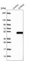 Anti-SCRN2 antibody produced in rabbit