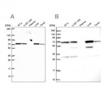 Anti-SDHA antibody produced in rabbit 