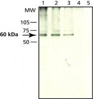 Anti-Seladin-1 (C-terminal) antibody produced in rabbit S8696-200UL