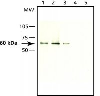Anti-Seladin-1 antibody produced in rabbit S8571-200UL