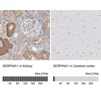 Anti-SERPINA1 antibody produced in rabbit 