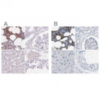 Anti-SERPINB1 antibody produced in rabbit HPA052642-100UL
