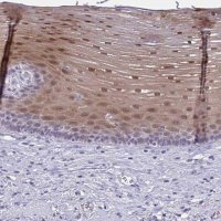 Anti-SERPINB13 antibody produced in rabbit 