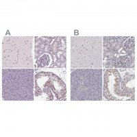 Anti-SETD1A antibody produced in rabbit 