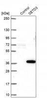 Anti-SETD3 antibody produced in rabbit HPA003639-100UL