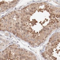 Anti-SETD3 antibody produced in rabbit HPA003639-100UL