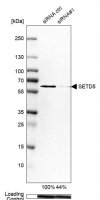 Anti-SETD5 antibody produced in rabbit