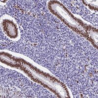 Anti-SETD5 antibody produced in rabbit