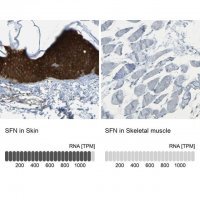 Anti-SFN antibody produced in rabbit 