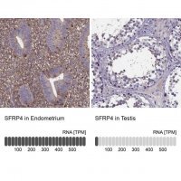 Anti-SFRP4 antibody produced in rabbit 