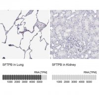 Anti-SFTPB antibody produced in rabbit