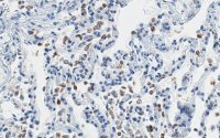 Anti-SFTPC Antibody, clone 3F18 ZooMAb� Rabbit Monoclonal 