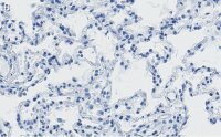 Anti-SFTPC Antibody, clone 3F18 ZooMAb� Rabbit Monoclonal 