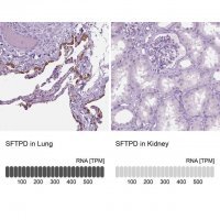 Anti-SFTPD antibody produced in rabbit 