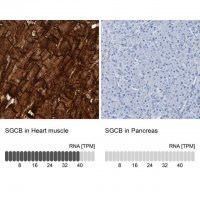 Anti-SGCB antibody produced in rabbit