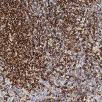 Anti-SH3BP1 antibody produced in rabbit 