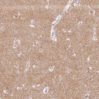 Anti-SH3GL2 antibody produced in rabbit 