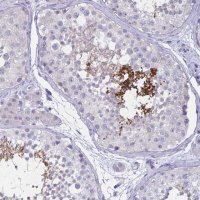 Anti-SH3GL3 antibody produced in rabbit 