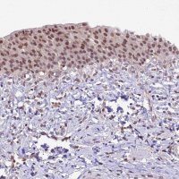 Anti-SHKBP1 antibody produced in rabbit 