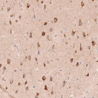 Anti-SHOC2 antibody produced in rabbit