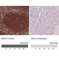 Anti-SIPA1 antibody produced in rabbit 