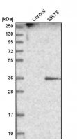 Anti-SIRT5 antibody produced in rabbit HPA021798-100UL