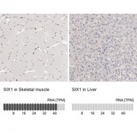 Anti-SIX1 antibody produced in rabbit