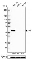 Anti-SIX1 antibody produced in rabbit