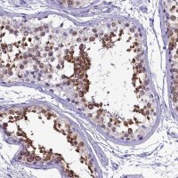 Anti-SKA3 antibody produced in rabbit