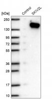 Anti-SKIV2L antibody produced in rabbit HPA051959-100UL