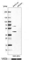 Anti-SKP2 antibody produced in rabbit HPA051196-100UL