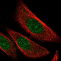 Anti-SKP2 antibody produced in rabbit HPA051196-100UL