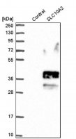 Anti-SLC10A2 antibody produced in rabbit