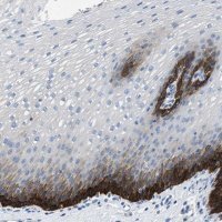 Anti-SLC10A6 antibody produced in rabbit 
