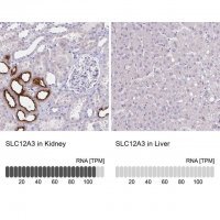 Anti-SLC12A3 antibody produced in rabbit 
