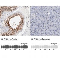 Anti-SLC16A1 antibody produced in rabbit 