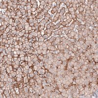 Anti-SLC16A2 antibody produced in rabbit 