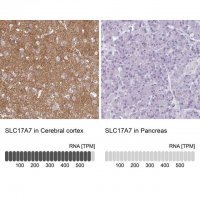 Anti-SLC17A7 antibody produced in rabbit 