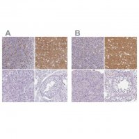 Anti-SLC17A7 antibody produced in rabbit 