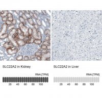 Anti-SLC22A2 antibody produced in rabbit