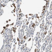 Anti-SLC25A20 antibody produced in rabbit 