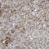 Anti-SLC26A11 antibody produced in rabbit